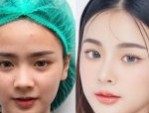 CHUYÊN KHOA TẠO HÌNH VÓC DÁNG