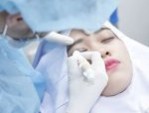 TOP bác sĩ cắt mí đẹp ở TpHCM uy tín, kỹ thuật đỉnh cao