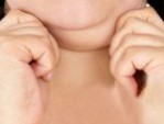 Hút mỡ nọng cằm giá bao nhiêu – 4 Yếu tố ảnh hưởng đến chi phí