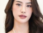 Nâng mũi S Line bọc sụn tai an toàn, mũi cao đẹp tự nhiên