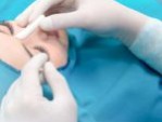 Phẫu thuật thẩm mỹ nâng mũi – Sở hữu dáng mũi chuẩn tỷ lệ vàng
