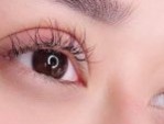 Bấm mí mắt có bị sưng không – Cách chăm sóc sau cắt mí mắt