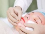 Căng da mặt bao lâu thì lành? Giải đáp từ bác sĩ thẩm mỹ