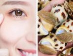 Cắt mí ăn ốc được không – 3 loại hải sản không nên ăn sau cắt mí
