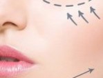 Cấy mỡ má bao nhiêu tiền – 3 Bí quyết giúp tối ưu chi phí