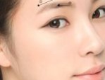 Thẩm mỹ Bệnh viện Hồng Hà – Địa chỉ nâng cung chân mày uy tín