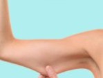 Hút mỡ bắp tay được bao lâu? Địa chỉ hút mỡ tay hiệu quả nhất