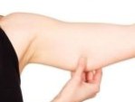 Hút mỡ bắp tay bao lâu hết sưng – Cách giảm sưng cấp tốc