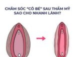 Kinh nghiệm thẩm mỹ vùng kín an toàn, bền đẹp