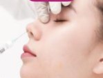 Nâng mũi bằng filler có đau không? Lưu ý khi thực hiện