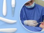 Nâng mũi bằng sụn nhân tạo có tốt không? KH và chuyên gia nói gì