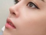 Nâng mũi nào tốt nhất? 3 Lưu ý quan trọng khi thực hiện