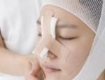 Nâng mũi kiêng ăn bao lâu? 3 nhóm thực phẩm nên ăn để mau lành