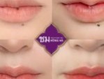 Tạo hình môi trái tim đẹp ở đâu đẹp – 3 Tiêu chí lựa chọn