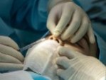 Thời gian nâng mũi bao lâu để có chiếc mũi đẹp tự nhiên?