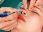 Thu nhỏ cánh mũi có nguy hiểm không: Một số lưu ý khi thực hiện