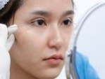 Bật mí 4 cách chăm sóc sau khi bấm mí lành đẹp thần tốc