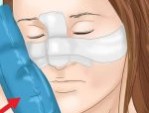 5 Tip chăm sóc nâng mũi sát Tết – Những lưu ý bạn nên biết