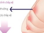 8 Thói quen khiến vòng 1 chảy xệ – Cách cải thiện hiệu quả
