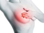 Bao xơ khi nâng ngực: Dấu hiệu, triệu chứng và 3 Cách khắc phục