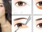Cắt mí dưới bao nhiêu tiền? 4 Yếu tố ảnh hưởng đến giá