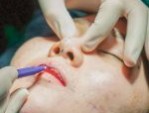 Cắt môi trái tim có đau không? – Bác sĩ Daniel Nguyễn giải đáp