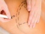 Ngực lép có nên nâng ngực không? – Bí quyết để có bộ ngực đẹp