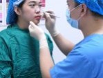 Chuyên gia giải đáp: Thu nhỏ cánh mũi có đau không?
