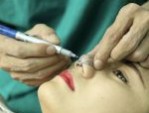 Thu nhỏ đầu mũi có đau không? – Cách giảm đau hiệu quả