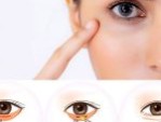 Cắt mí dưới có hết nhăn không – Trẻ hóa đôi mắt sau cắt mí