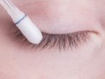 Cắt mí mắt có bị sẹo lồi không? Tip xử lý sẹo sau khi cắt mí mắt