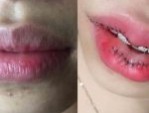 Cắt môi trái tim bao lâu thì lành? 5 Tip chăm sóc môi đẹp
