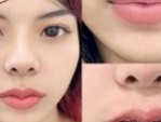 Bật mí: Kinh nghiệm cắt môi trái tim từ chuyên gia và khách hàng