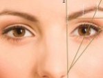 Nâng cung mày có để lại sẹo không – Cách chăm sóc tránh gây sẹo
