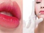 Tiêm môi trái tim có hại không – Hạn chế các biến chứng sau tiêm