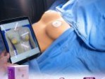 Review của khách hàng thực hiện dịch vụ nâng ngực X – Breast