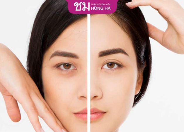 Đội ngũ bác sĩ chuyên khoa mắt giàu kinh nghiệm