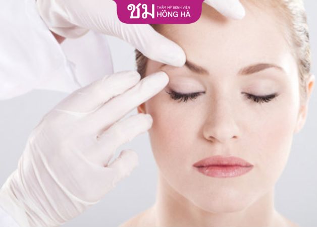 Nữ giới trên 18 tuổi đủ điều kiện treo cơ mi