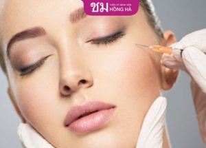 Cấy mỡ vùng mặt – Phương pháp thẩm mỹ hiện đại, ít xâm lấn