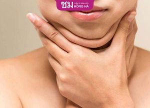 Hút mỡ cằm – Loại bỏ 99% mỡ thừa sau 1 lần thực hiện