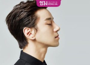 Nâng mũi cho nam: Chỉ định phương pháp phù hợp với tình trạng mũi