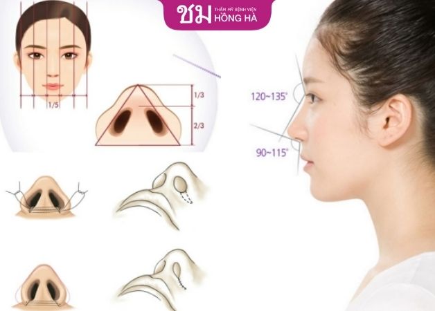 Phương pháp cuộn cánh mũi đem đến dáng mũi nhỏ gọn