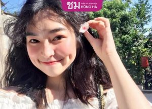 Tạo má lúm đồng tiền có vĩnh viễn không? Bao lâu thì đẹp tự nhiên