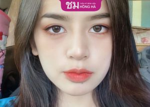 Bấm mí Thái Lan ở đâu đẹp – Địa chỉ bấm mí chuẩn Thái uy tín