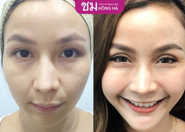 Đôi mắt 2 mí rõ ràng, sắc nét