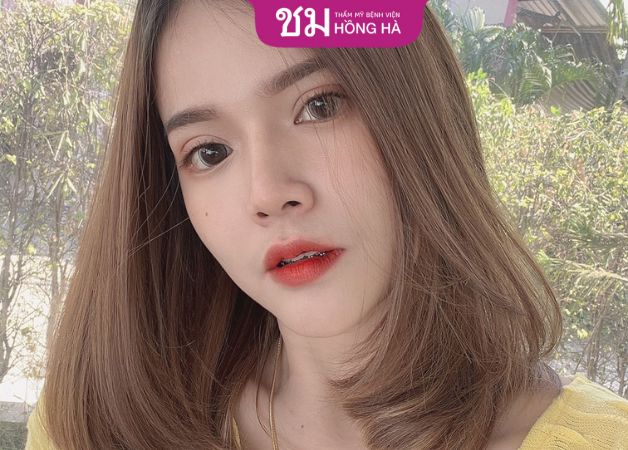 Tuân thủ hướng dẫn chăm sóc hậu phẫu là bí quyết giảm sưng đau