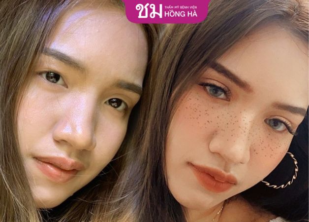 Khách hàng đánh giá cao về chất lượng dịch vụ của Thẩm mỹ bệnh viện Hồng Hà