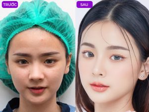 CHUYÊN KHOA TẠO HÌNH VÓC DÁNG