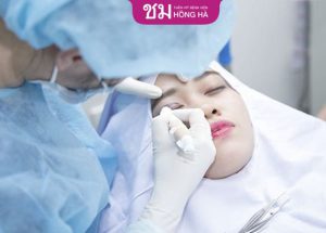 TOP bác sĩ cắt mí đẹp ở TpHCM uy tín, kỹ thuật đỉnh cao