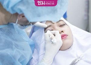 Bấm mí mắt – Sở hữu đôi mắt thu hút sau 40 phút